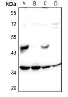 SH2D5 Antibody