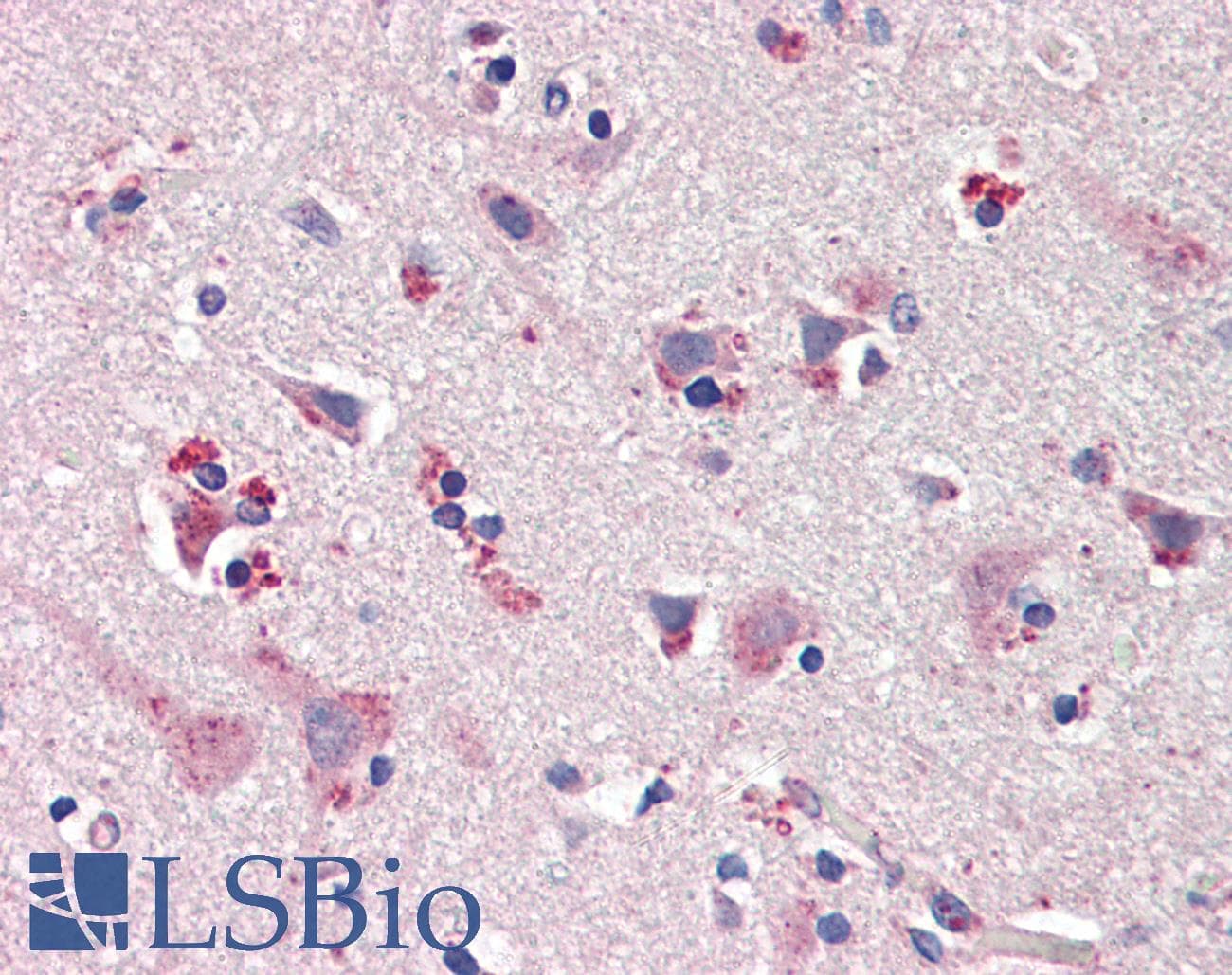 PathPlus™ Polyclonal Rabbit anti-Human NOS1 / nNOS Antibody (C-Terminus, IHC, WB)