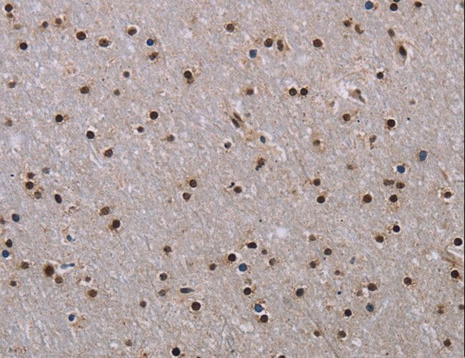 JMJD6 / PSR Antibody