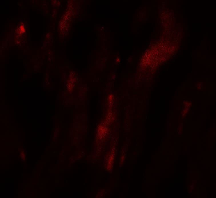 Polyclonal Rabbit anti-Human HOPX / HOP Antibody (IHC, IF, WB)