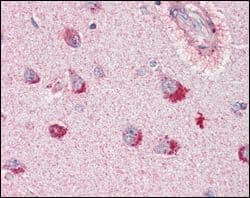 Monoclonal Mouse anti-Human SORL1 Antibody (clone 3B6B11, IHC, IF, WB)