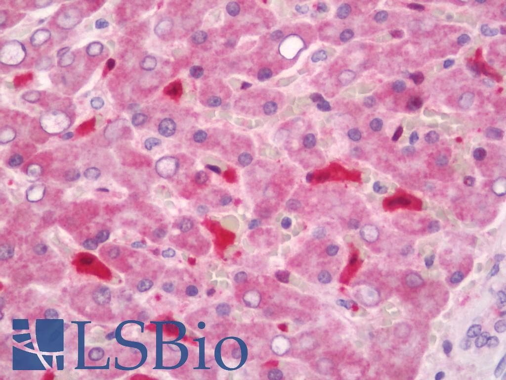 IHC-plus™ Polyclonal Rabbit anti-Human GPX1 / Glutathione Peroxidase Antibody (aa164-193, IHC, IF, WB)