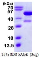 Human KAT2A / GCN5 Protein (Recombinant His)