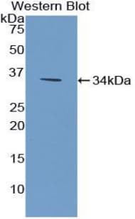 Polyclonal Rabbit anti-Mouse CILP Antibody (aa604-864, WB)