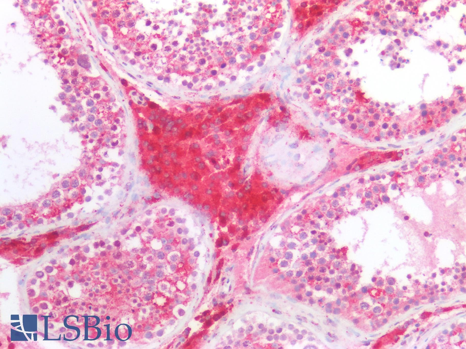PathPlus™ PSAP / Prosaposin Antibody (aa1-250)