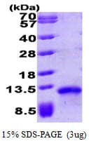 Human CCL17 / TARC Protein (Recombinant His)