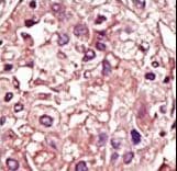 Polyclonal Rabbit anti-Human TGFBR1 / ALK5 Antibody (aa134-163, IHC, WB)