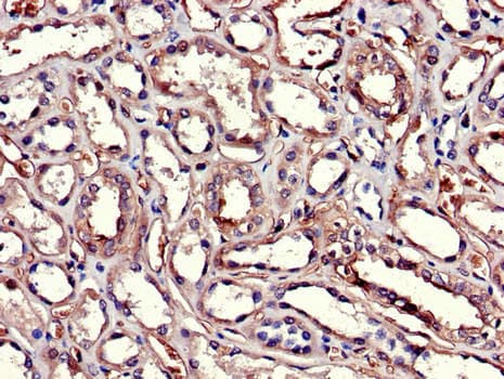 GSTA1 Antibody