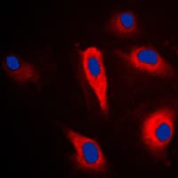 Polyclonal Rabbit anti-Human KRT16 / CK16 / Cytokeratin 16 Antibody (C-Terminus, IHC, IF, WB)