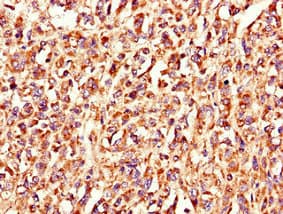 LSMEM1 / C7orf53 Antibody