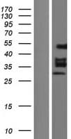 EGR2 Protein (Over-Expression Lysate Myc-DDK (Flag))