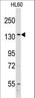 VARS / ValRS Antibody (aa679-707)