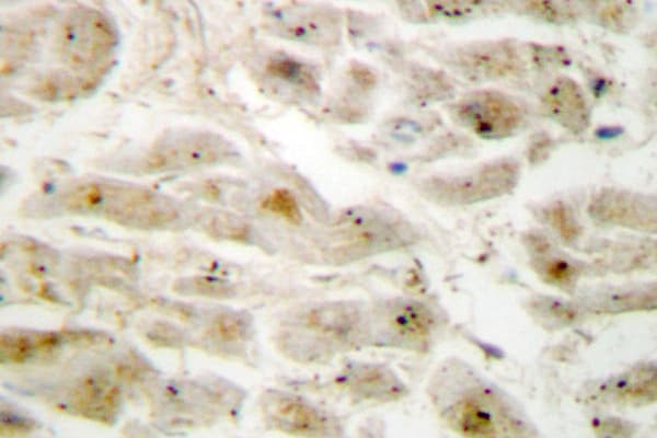 Polyclonal Rabbit anti-Human LIMK2 Antibody (Lys491, IHC, IF, WB)