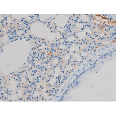 GJA1 / CX43 / Connexin 43 Antibody (phospho-Ser367)