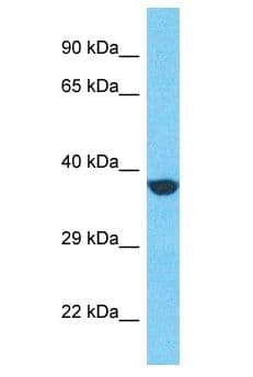 Polyclonal Rabbit anti-Human GPR31 Antibody (aa205-254, WB)