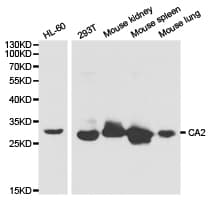 IHC-plus™ CA2 / Carbonic Anhydrase II Antibody