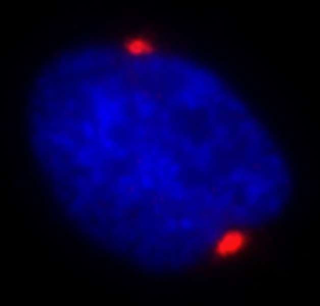 Polyclonal Rabbit anti-Human PCNT / Pericentrin Antibody (aa175-225, IF)