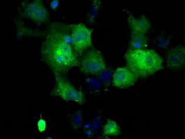 Monoclonal Mouse anti-Human GBE1 Antibody (clone OTI1D11, IHC, IF, WB)