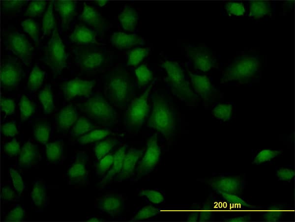 SMAD1 Antibody (clone 1D3)
