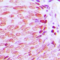 KLF10 + KLF11 Antibody (C-Terminus)