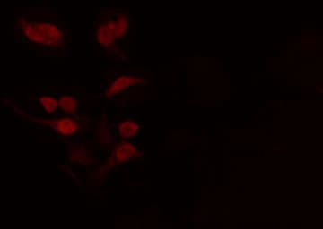 TCFL5 Antibody