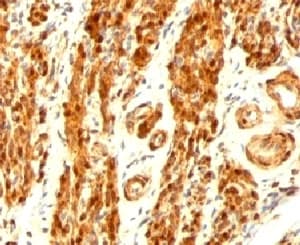 Calponin Antibody (clone CNN1/832)