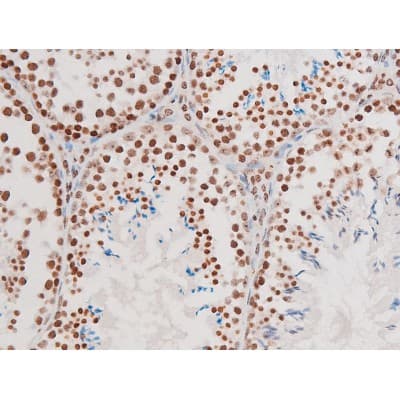 Polyclonal Rabbit anti-Human RELA / NFKB p65 Antibody (phospho-Thr435, IHC, IF, WB)