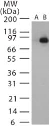 LF / Lethal Factor Antibody (aa47-65)
