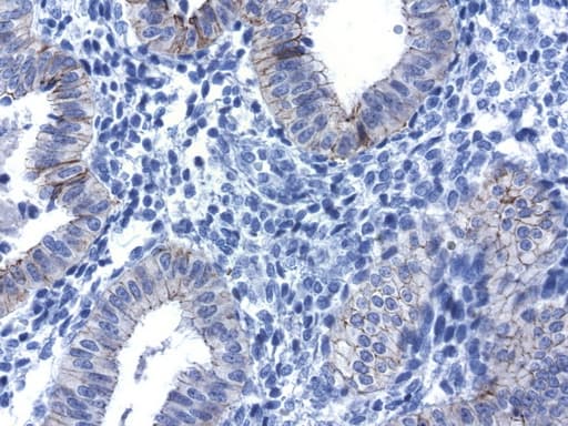 CDH1 / E Cadherin Antibody (clone UMAB184)