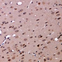 Polyclonal Rabbit anti-Human GLCNE / GNE Antibody (IHC, WB)