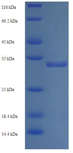 Human TXNDC12 Protein (Recombinant His-SUMO)