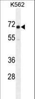 Polyclonal Rabbit anti-Human CRD-BP / ZBP1 / IGF2BP1 Antibody (aa508-534, IHC, WB)