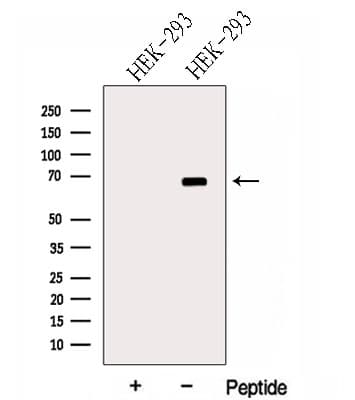 Harmonin / USH1C Antibody