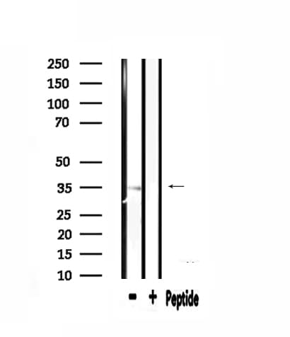 Polyclonal Rabbit anti-Human RPL5 / Ribosomal Protein L5 Antibody (IF, WB)