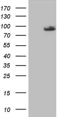 PLOD2 Antibody (aa359-640, clone OTI1A12)
