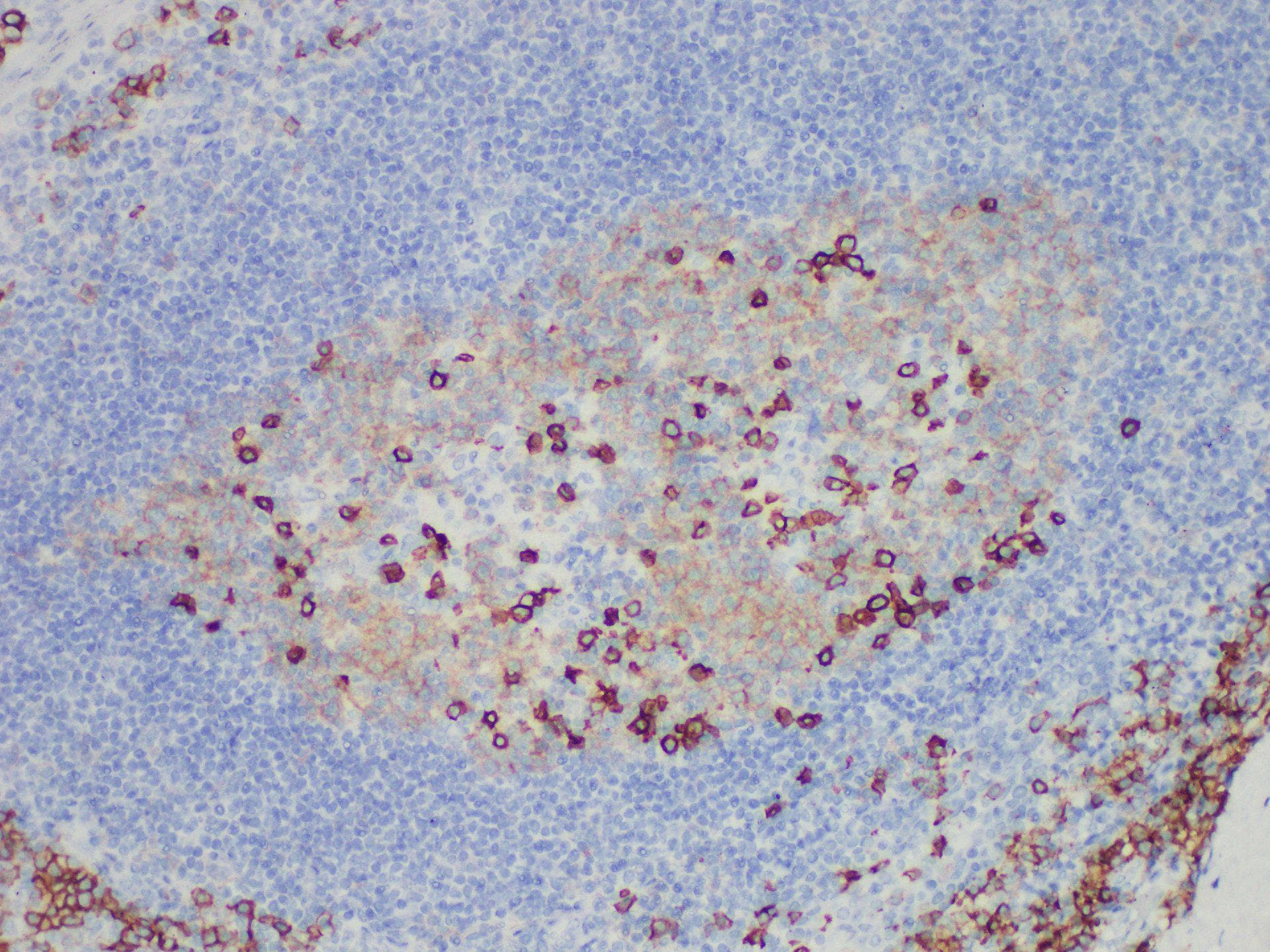 CD38 Antibody