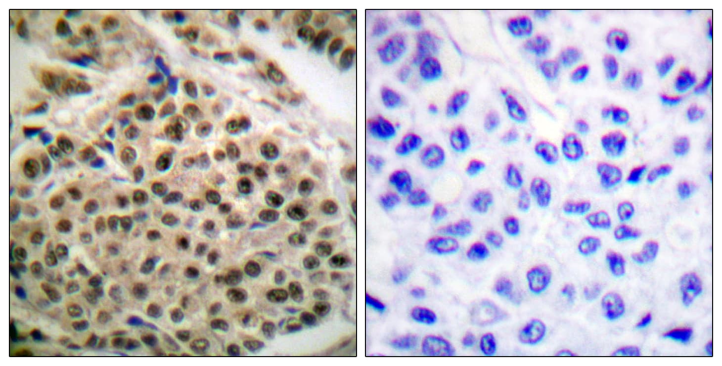 NFKB1 / NF-Kappa-B Antibody (phospho-Ser927)