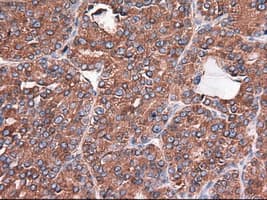 Monoclonal Mouse anti-Human CPA1 / Carboxypeptidase A Antibody (clone OTI2A3, IHC, IF, WB)