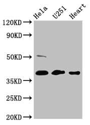 Polyclonal Rabbit anti-Human RCN3 Antibody (IHC)