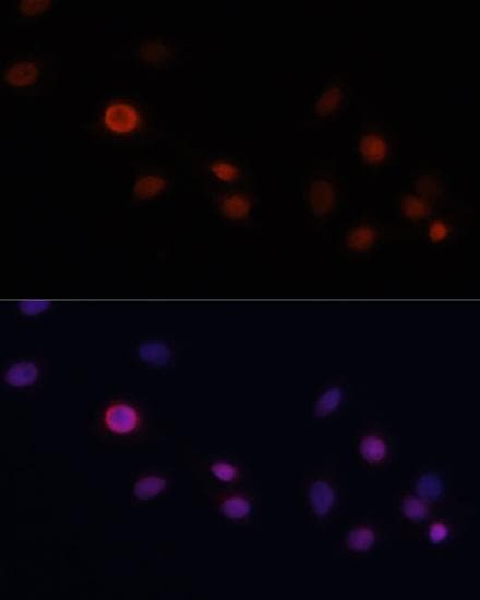 Polyclonal Rabbit anti-Human NSG1 Antibody (IF, WB)