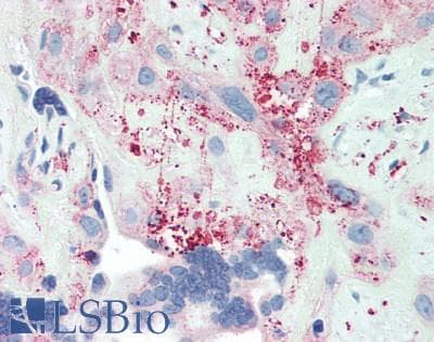 Proteoglycan 4 / Lubricin Antibody (aa1151-1241)