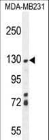 Polyclonal Rabbit anti-Human ZSWIM6 Antibody (aa1148-1177, IHC, WB)