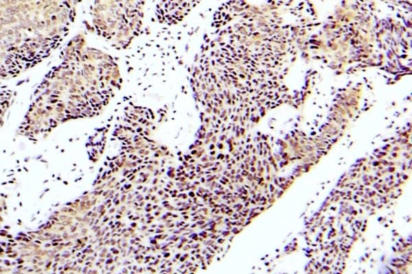 Polyclonal Rabbit anti-Human MAP3K5 / ASK1 Antibody (phospho-Ser83, IHC)