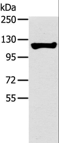 TERT / Telomerase Antibody