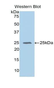 GPX5 Antibody (aa22-221, PE)