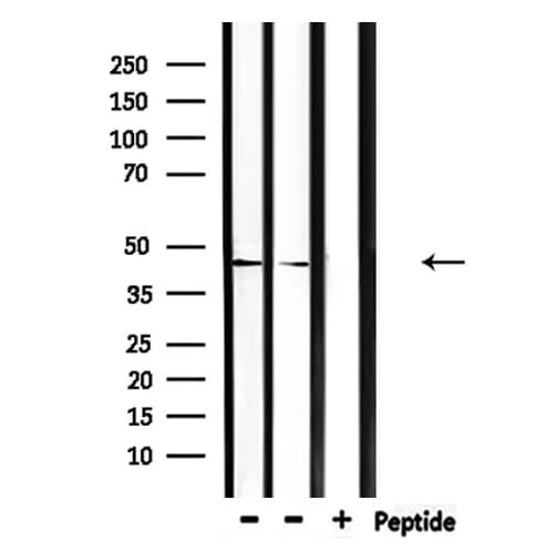 CEAL2 / CEACAM16 Antibody