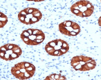 KRT20 / CK20 / Cytokeratin 20 Antibody (clone CTKN20-1)
