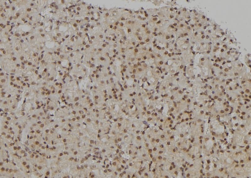 NIRF / UHRF2 Antibody
