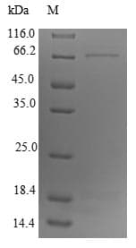 Mouse DCT / Dopachrome Tautomerase Protein (Recombinant 10His-SUMO, N-terminus + Myc, C-terminus)