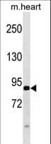 Polyclonal Rabbit anti-Human ATG9A Antibody (aa252-281, IHC, WB)